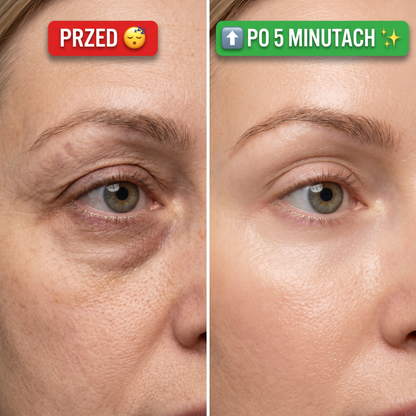 🎁 KUP JEDEN, DRUGI GRATIS - PODNIESIENIE W 5 MINUT
