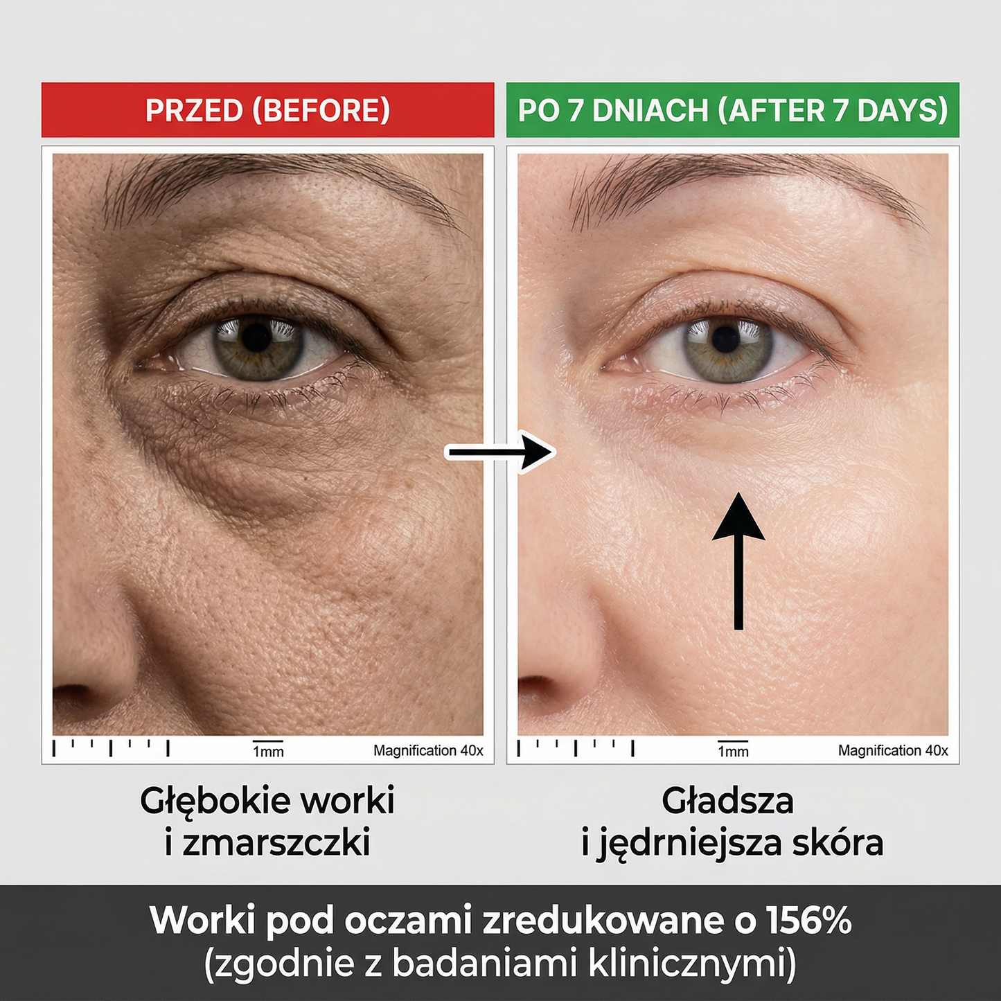 Kup 1 Tubkę — Drugą Dostaniesz GRATIS 🎁 "  Płacisz dopiero przy odbiorze."
