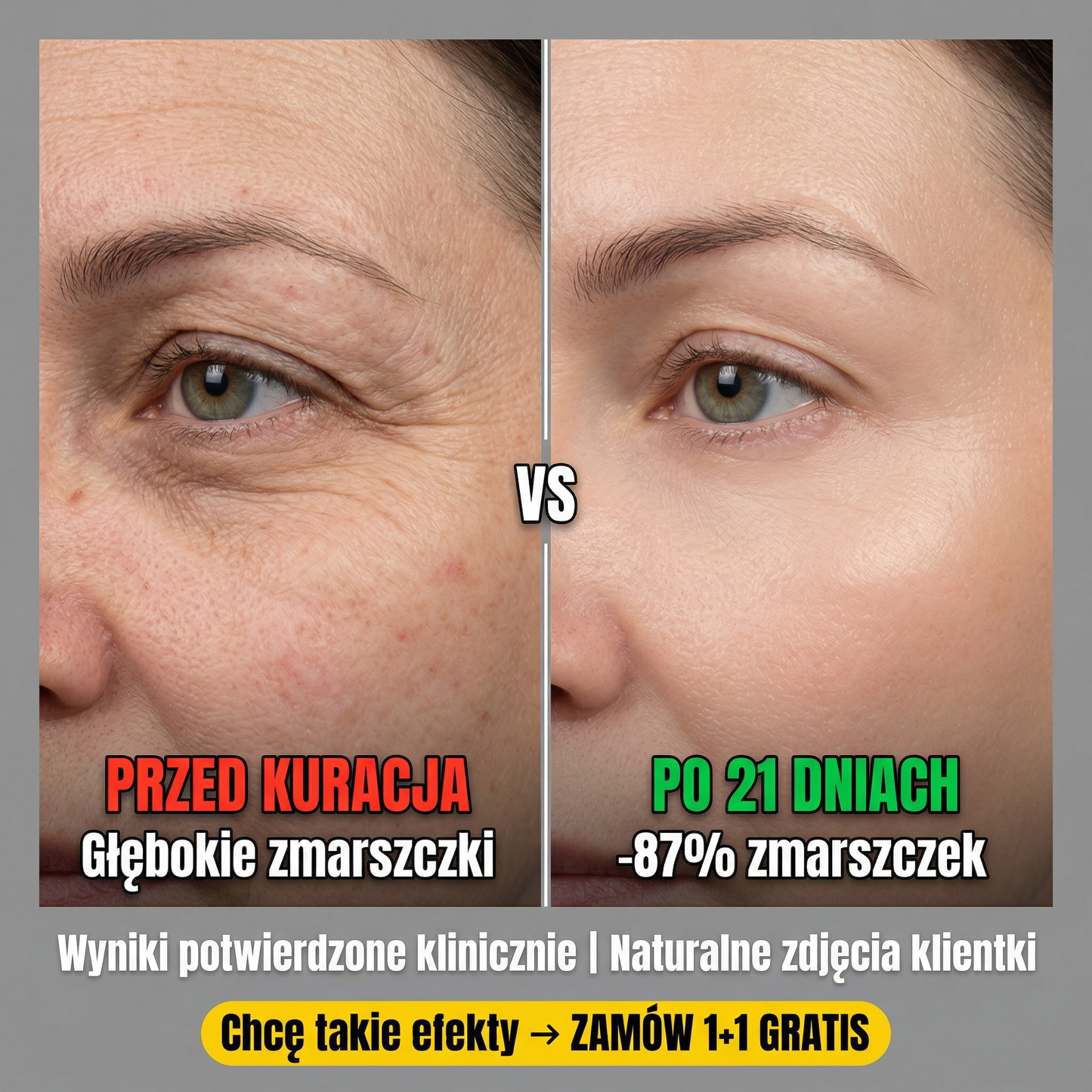 🚨  Kup 1 Dostań 1 GRATIS! Rewolucyjny Krem Pod Oczy Za Jedyne 89,99 zł| Dostawa z dostawą