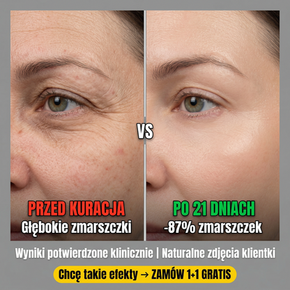 🚨  Kup 1 Dostań 1 GRATIS! Rewolucyjny Krem Pod Oczy Za Jedyne 89,99 zł| Dostawa z dostawą