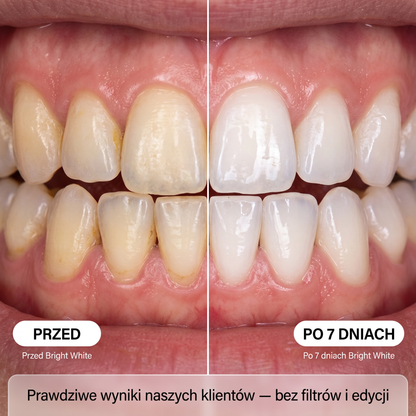 2 tubki, 1 cena, efekt jak po dentyscie ✨— płatność przy odbiorze✅